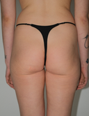 MY PANTIES (BIFLEX THONG)